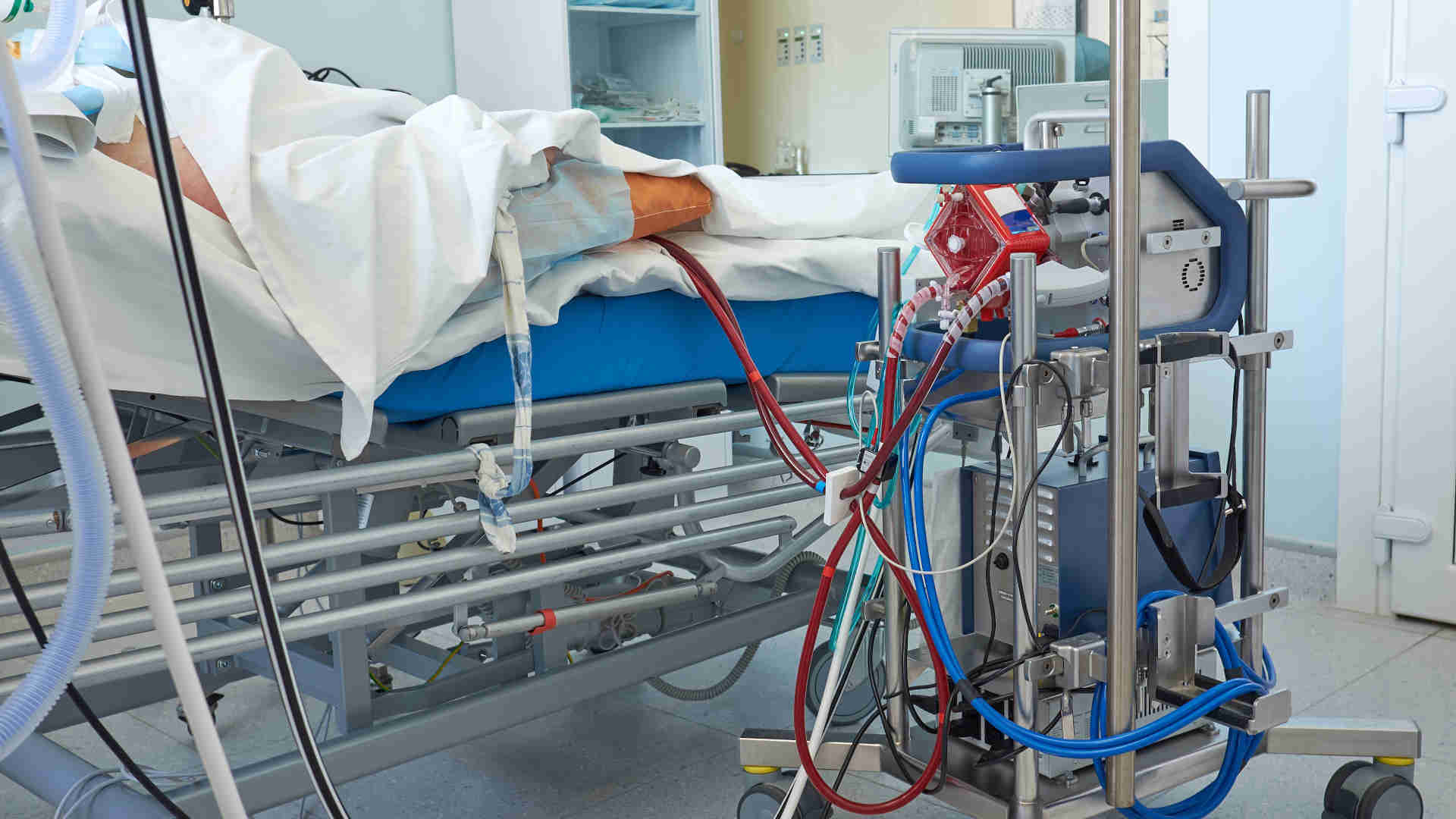 ECMO machine beside a patient