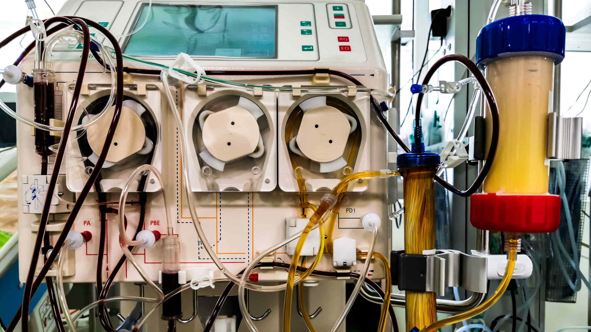 Plasma haemadsorption machine