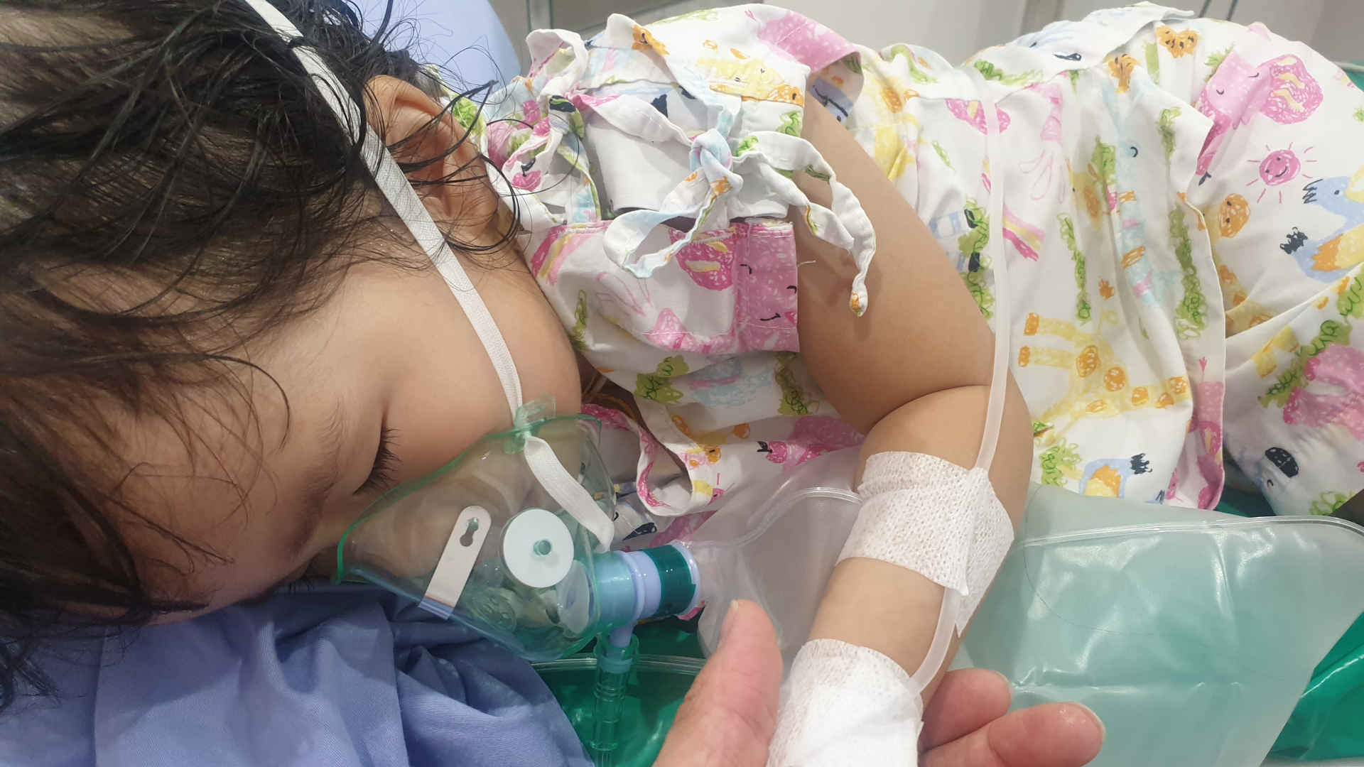Infant lying semi prone in the PICU