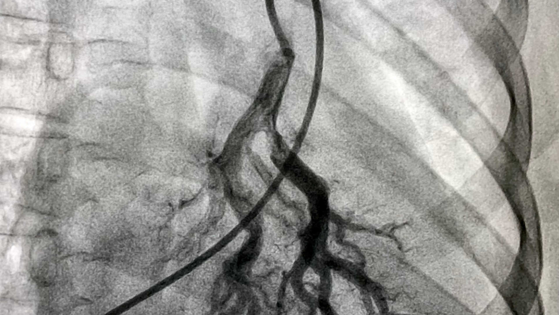 Child having his lungs auscultated