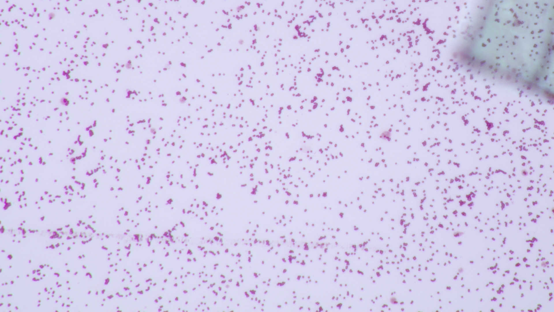 Staphlococcus Aureus on gram stain